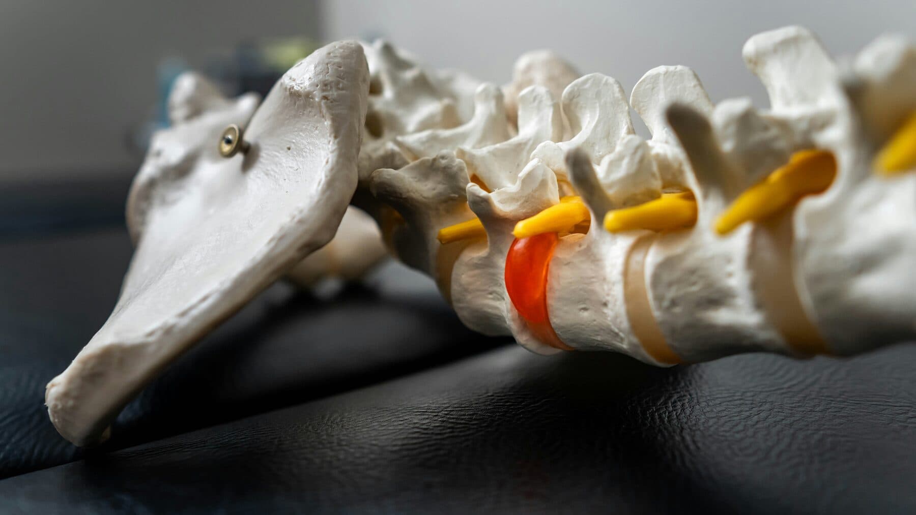 Neurologische Erkrankungen